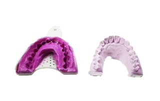 Understanding Alginate Impression Materials