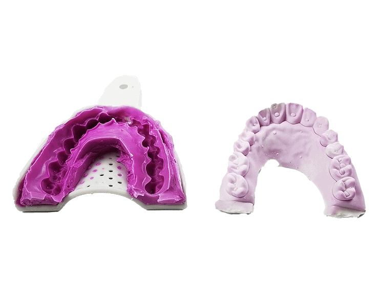 dental impression alginate material Dental impression tray filled with alginate material capturing detailed tooth impressions